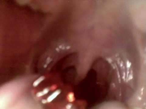 Swallow Gummy - video 5