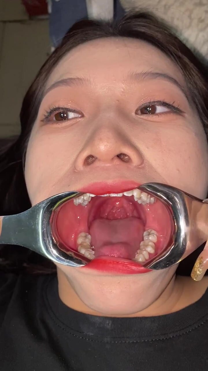 CHINESE GIRL OPEN MOUTH 3 - ThisVid.com