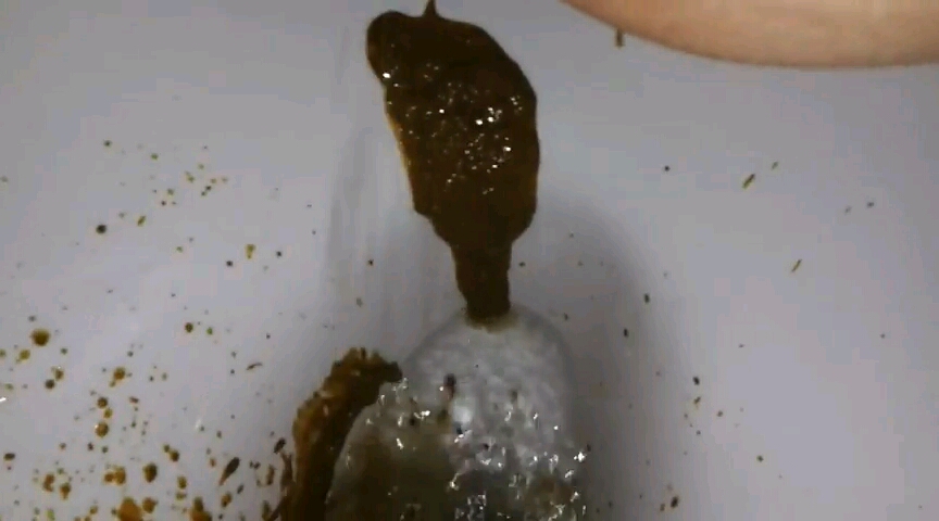 Diarrhea squirt