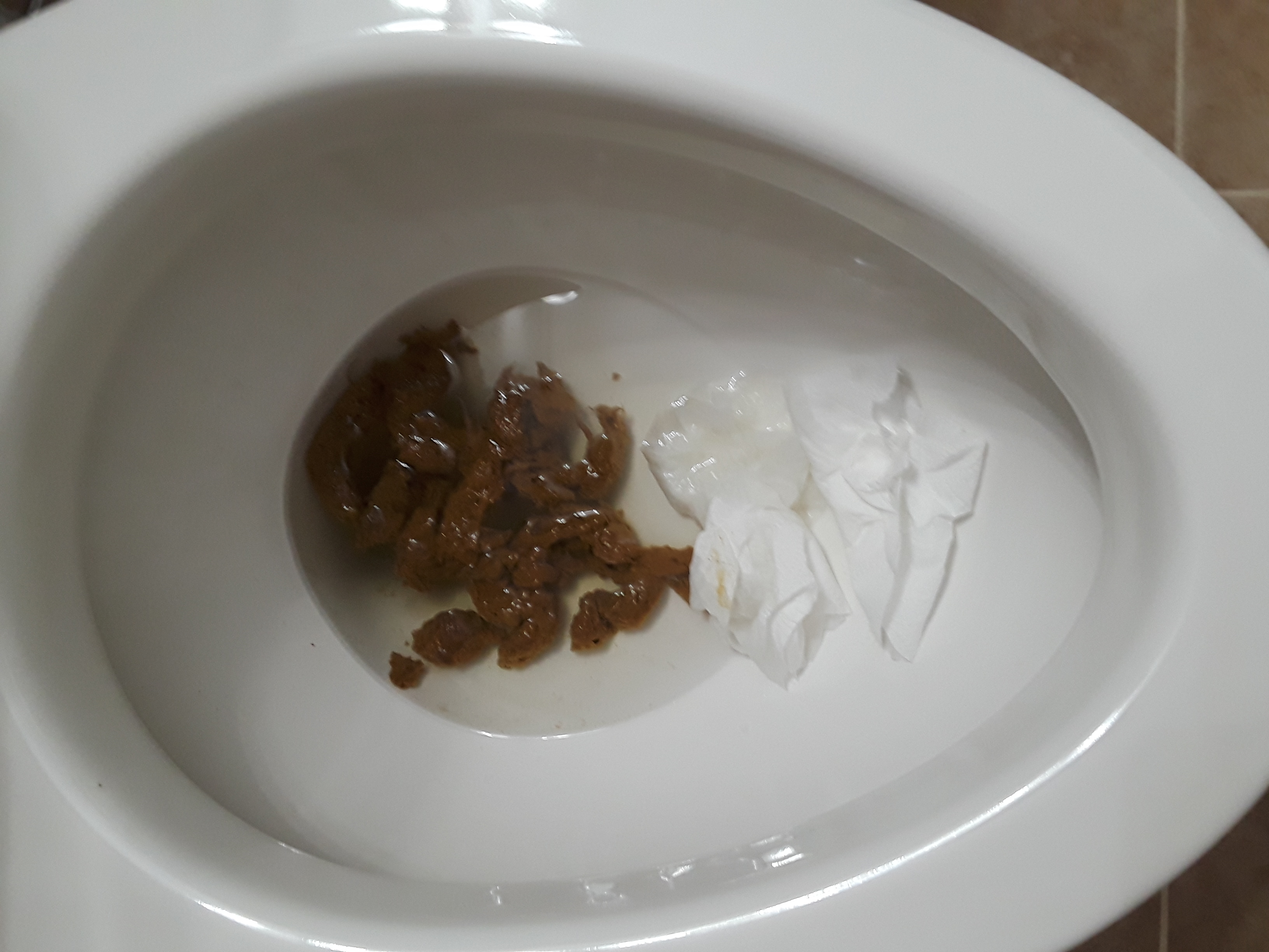 11-24-18 Greasy shit and close up piss