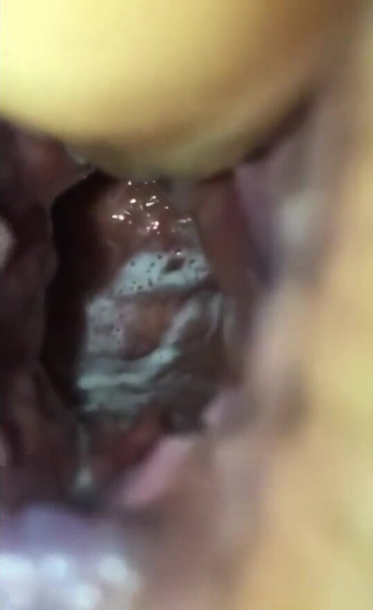 The view inside a spermed gaped asshole