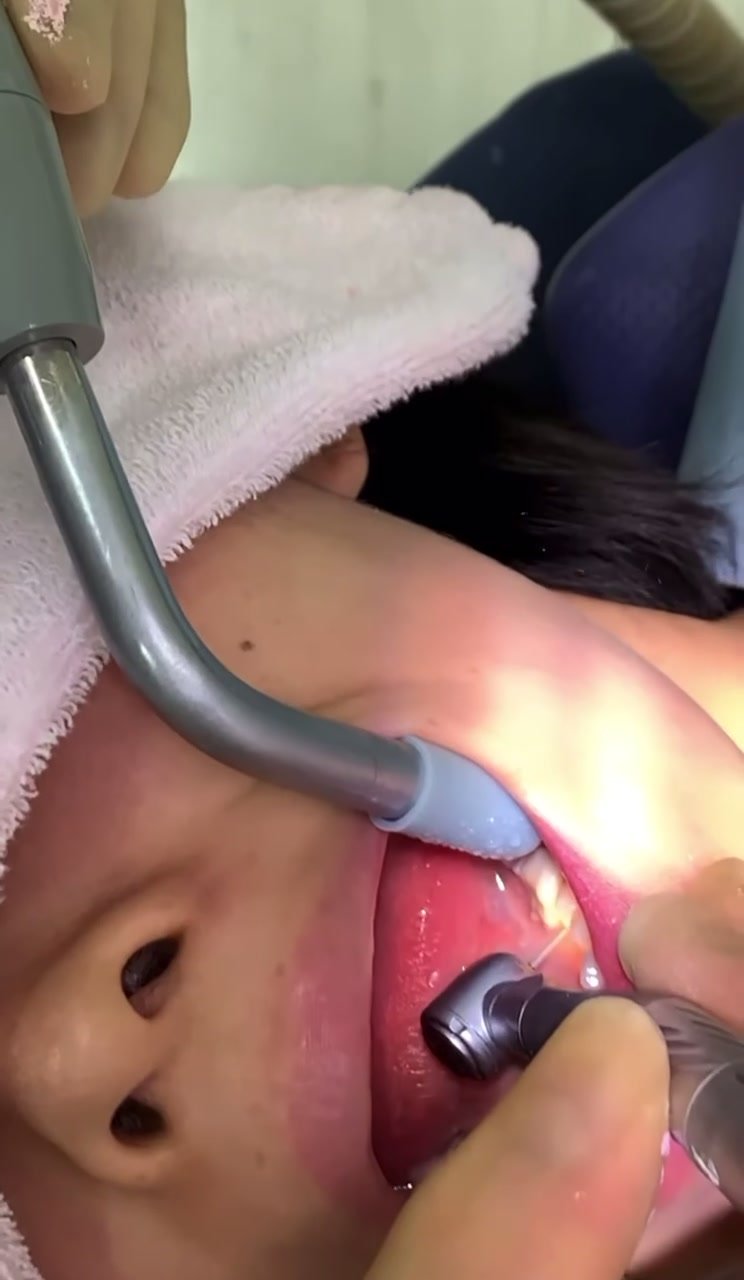 Japanese girl getting drilled by dentist pov