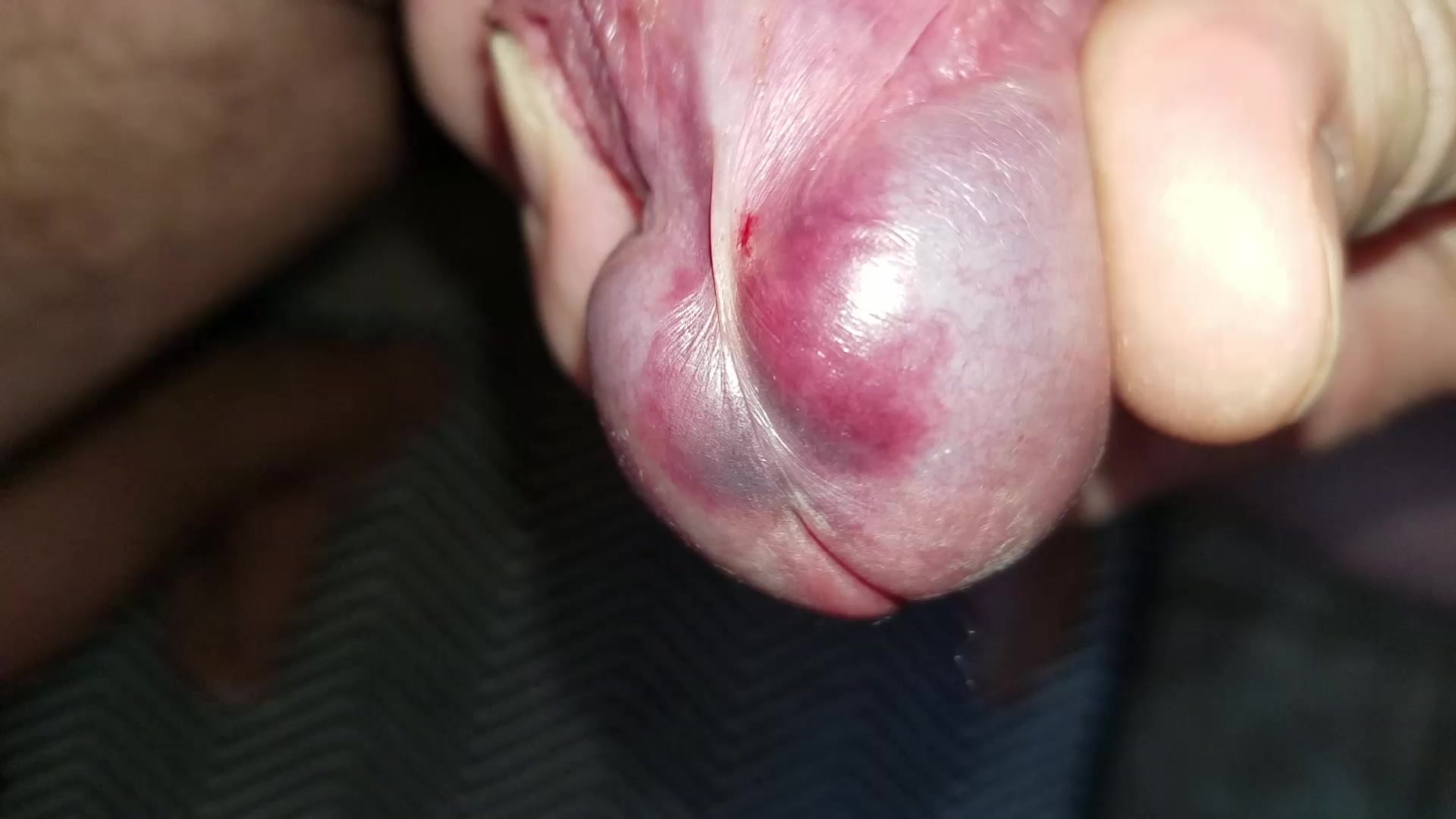 My first masturbation 5 hours after pulling the nails