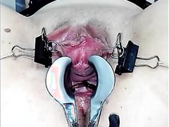 Gail Takes Worms In Gaping Pussy Hole