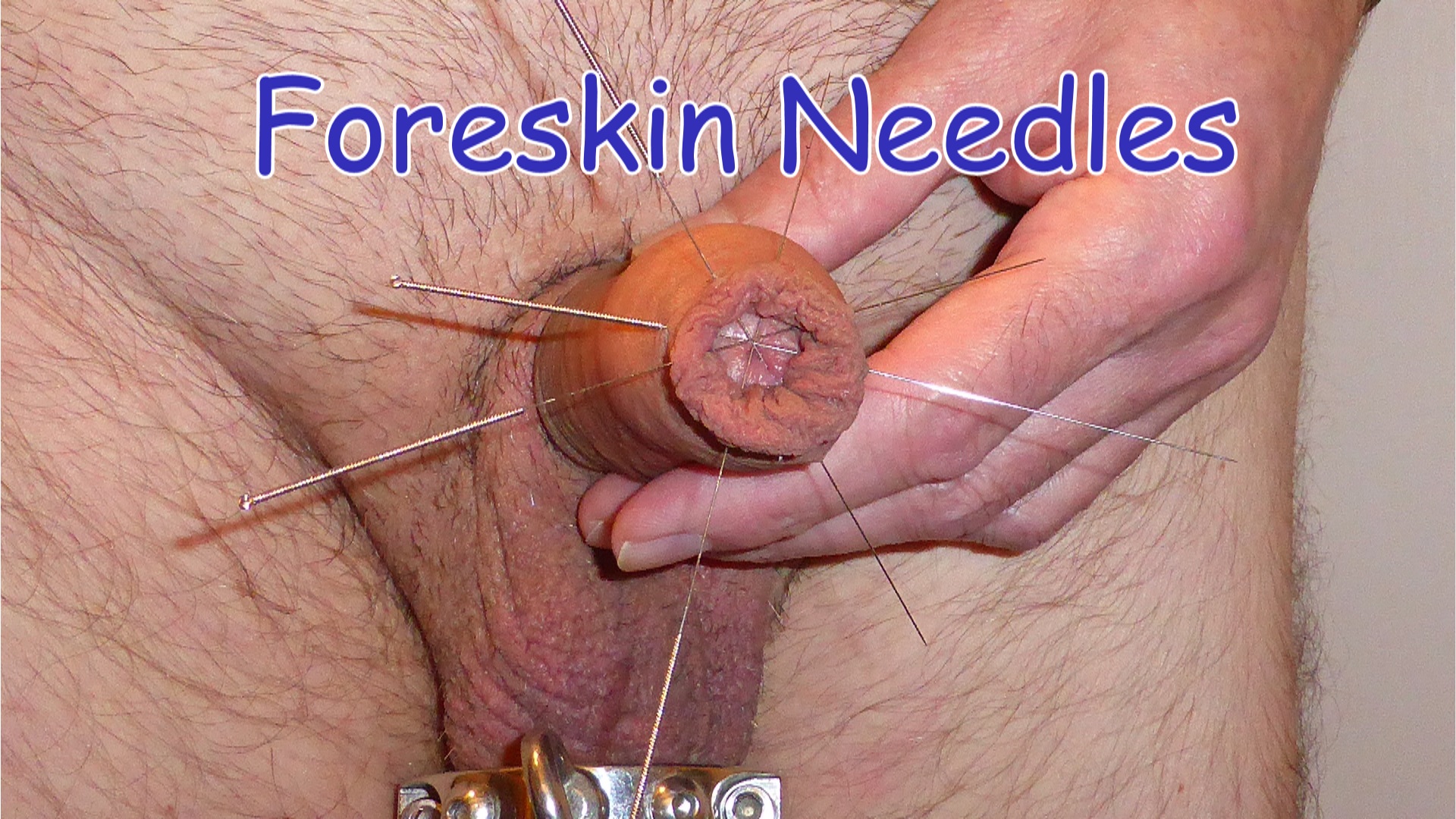 Foreskin Needles