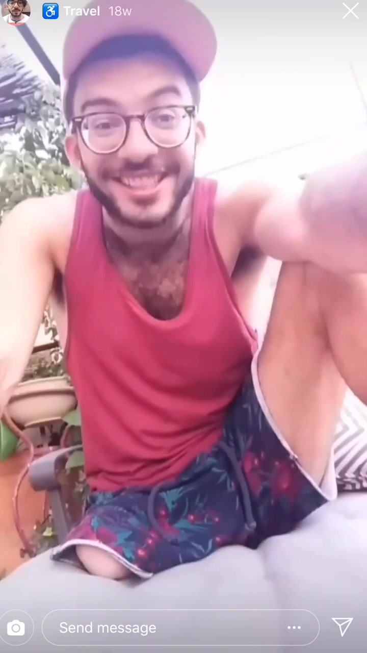 Cute amputee - video 2
