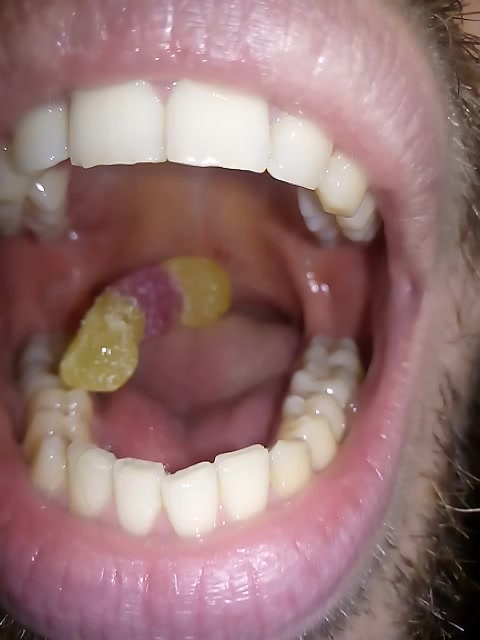 Gummy swallowing