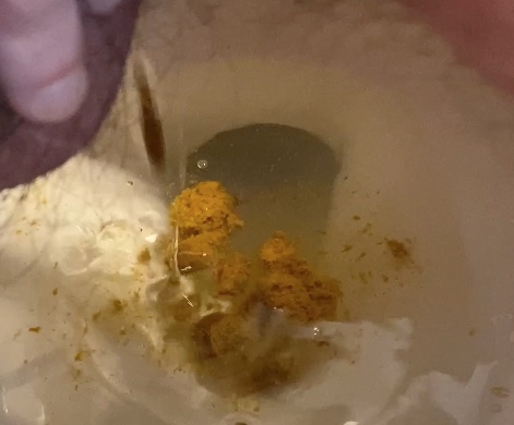 Farty Nuggets and Loose Shit