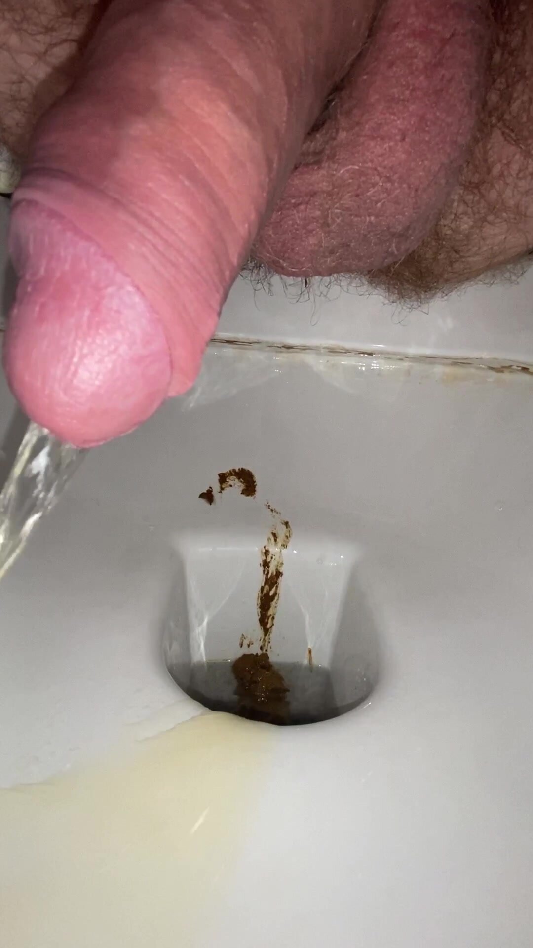 Urgent smooth shits and diarrhoea