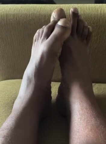 My boyfriends huge big toe