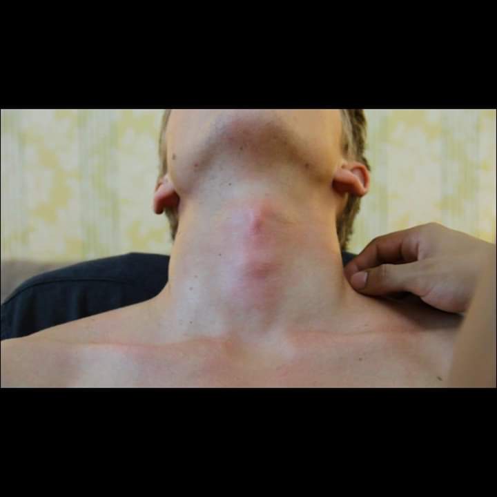 Strangle neck - video 3