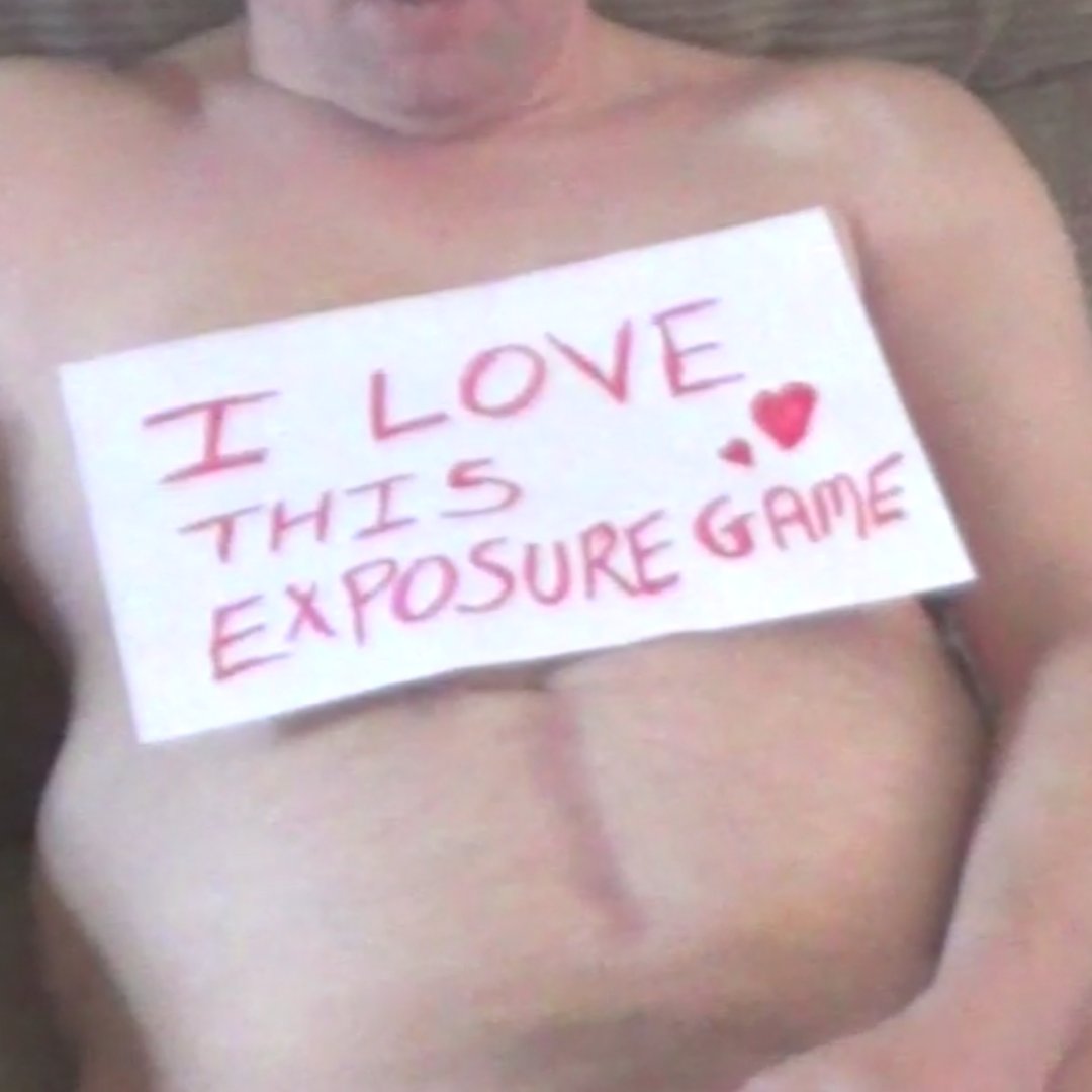 The Exposure Game