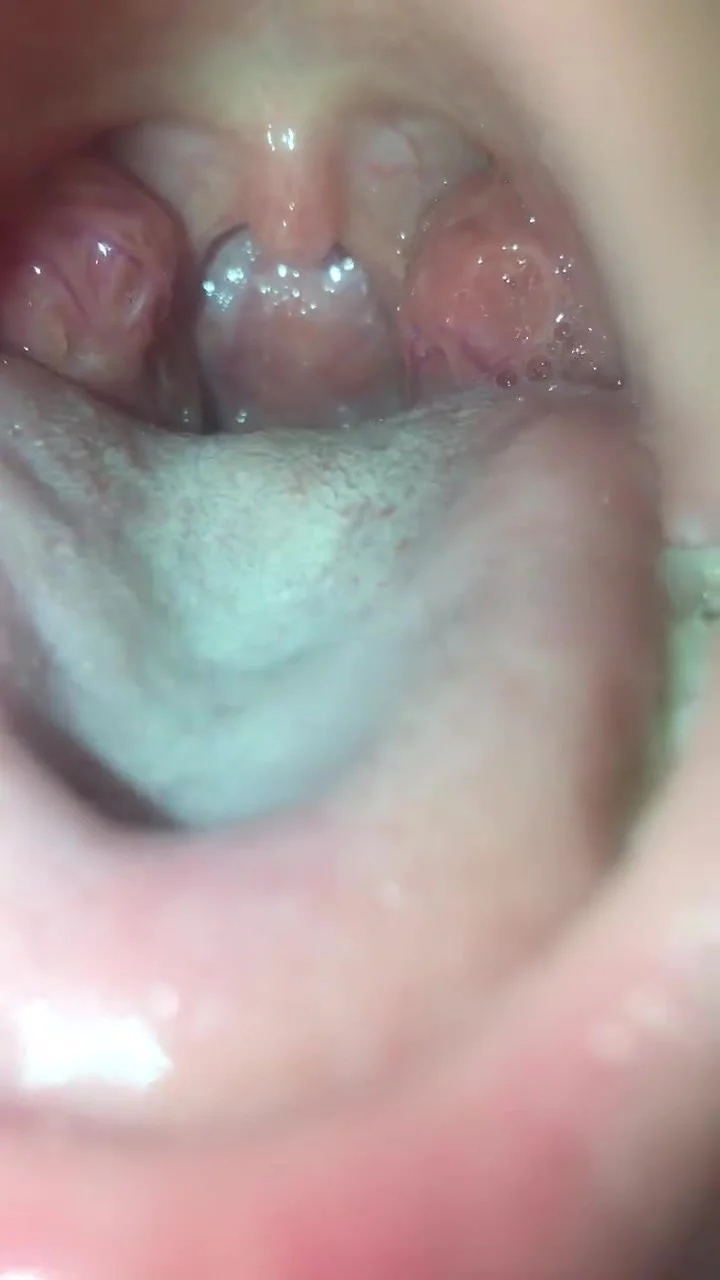 Video: Wet cute asian girl mouth - ThisVid.com