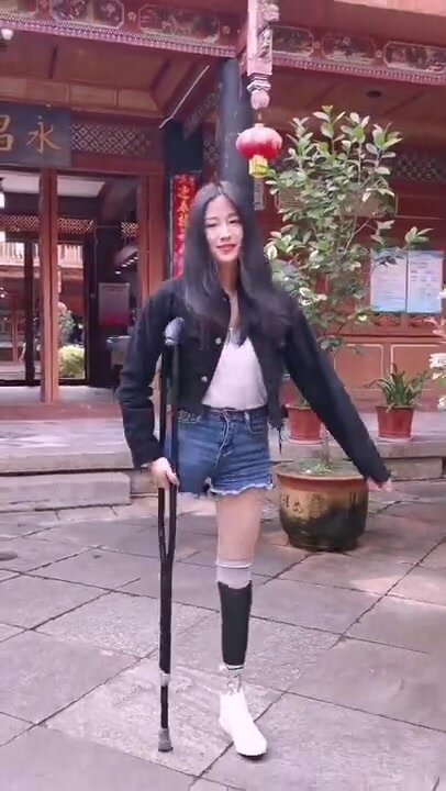 AK BK amputee girl crutching