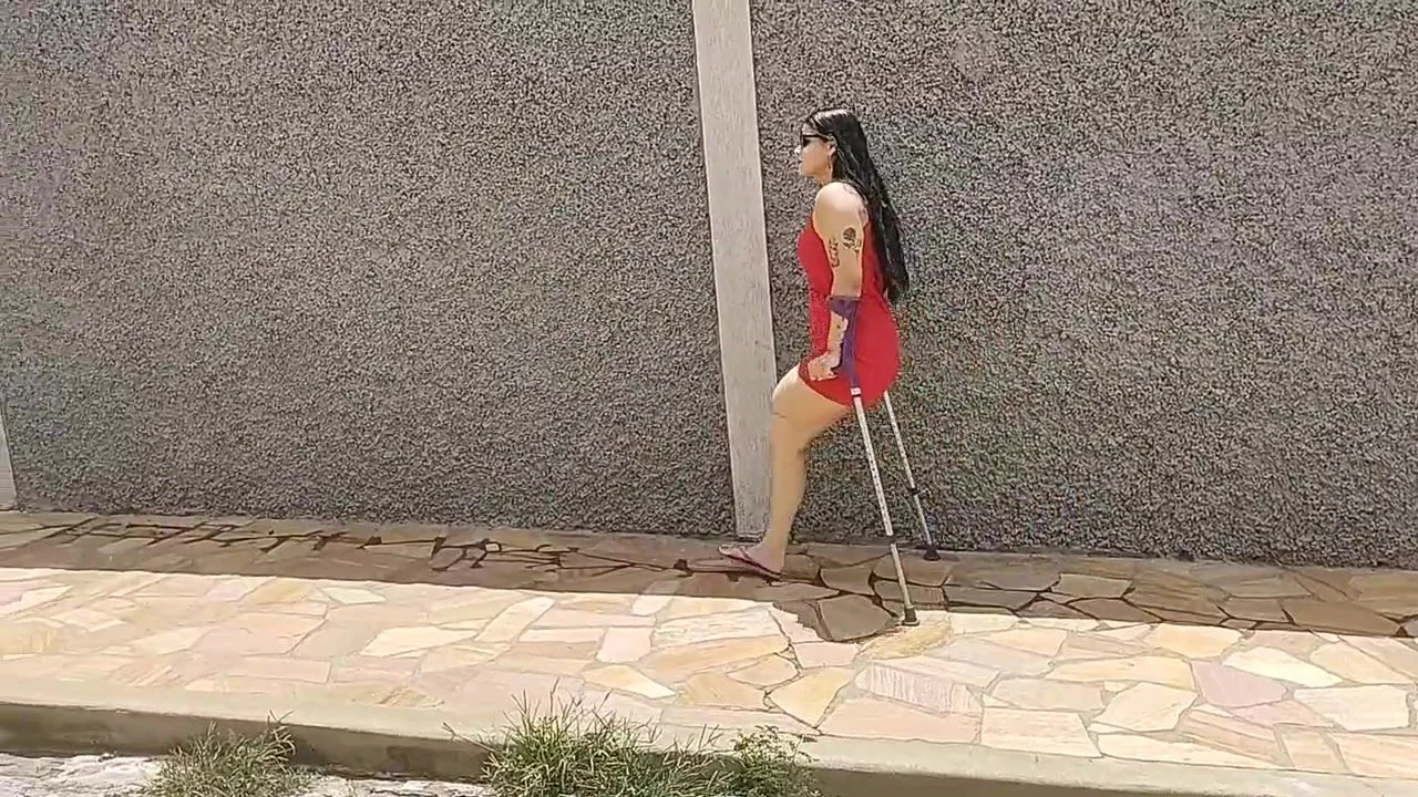 Amputee Alana - ThisVid.com 中文