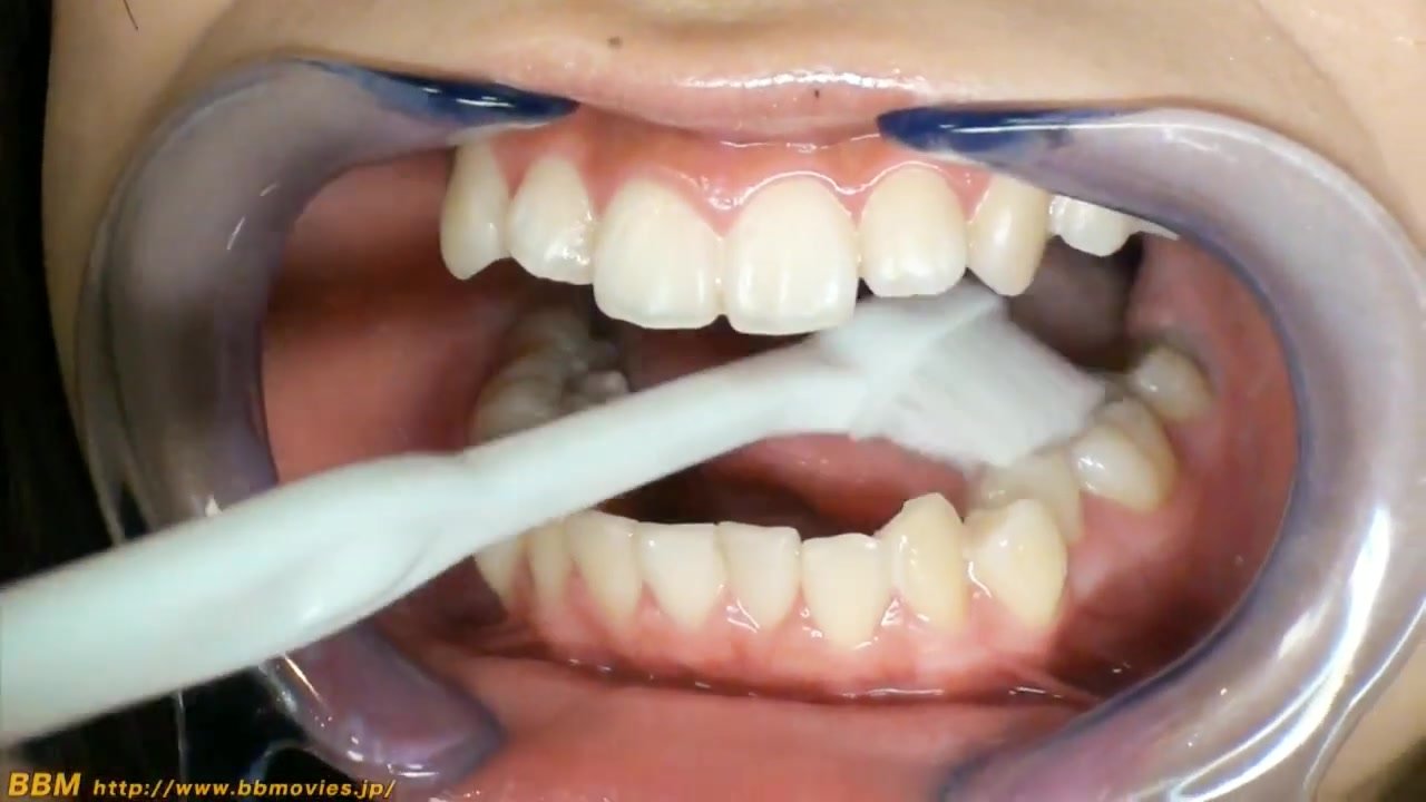 asian mouth teeth