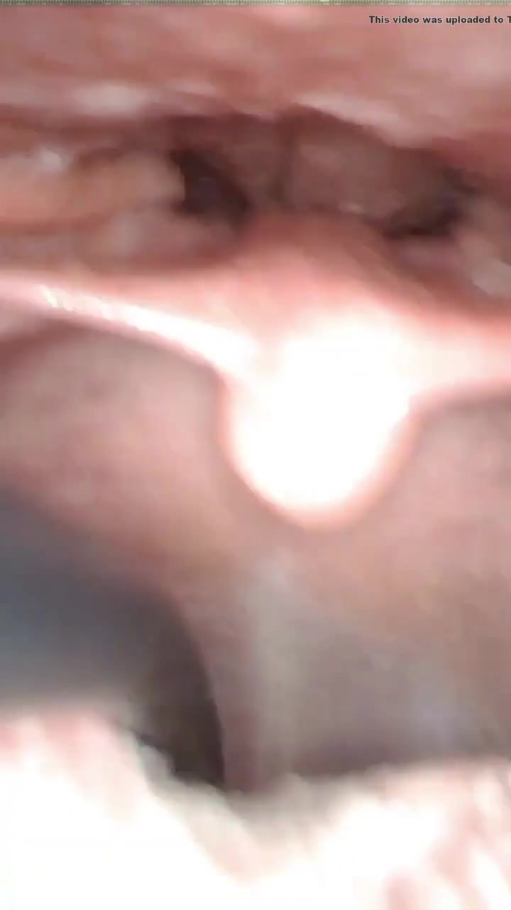throat view from inside
