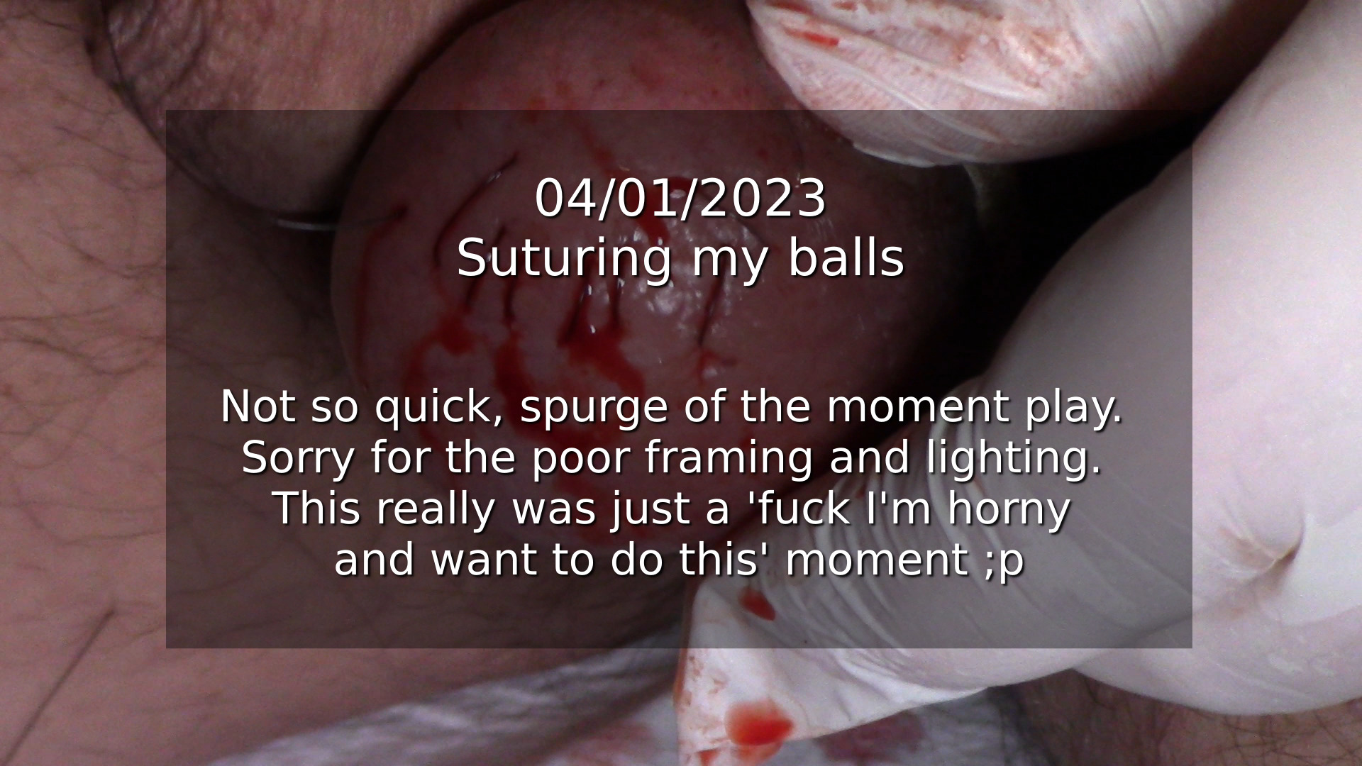 04012023_sutures