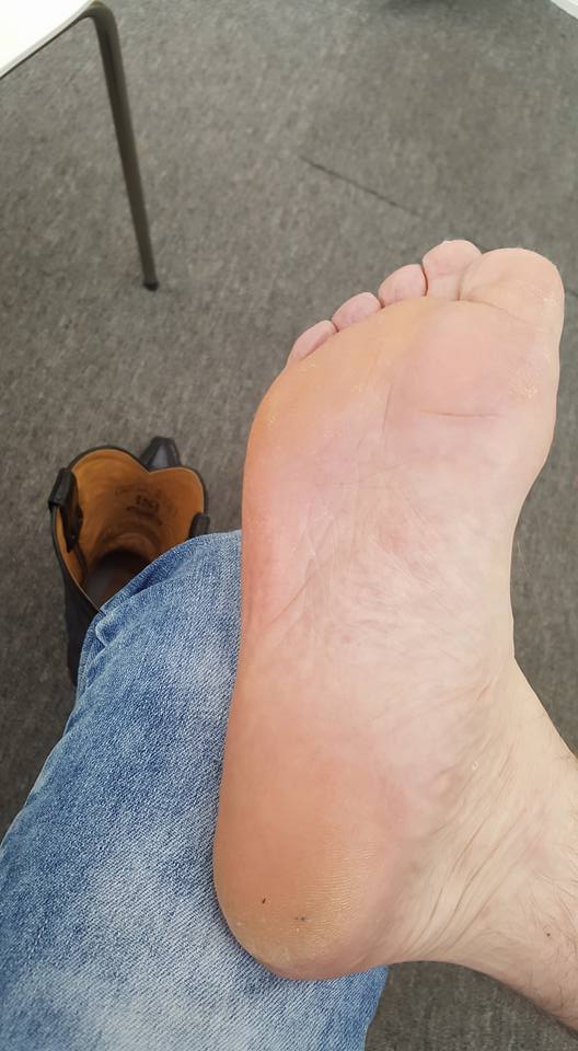 giant feet - video 11
