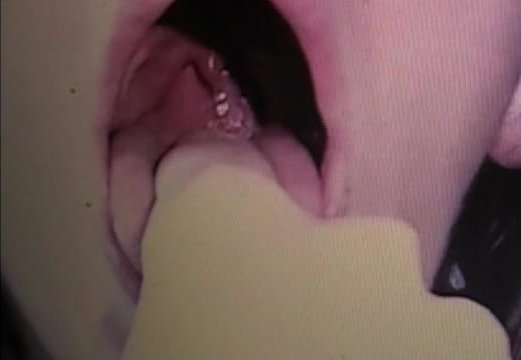 camgirl throat coughing no tonsils  (2018) - video 10