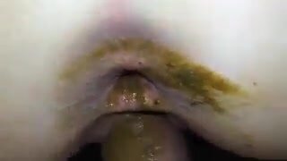 Dirty Ass Slut Gets Pussy Fucked By Shit Covered Cock