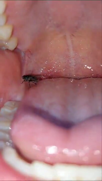 Insect inside the mouth of a giant teenager