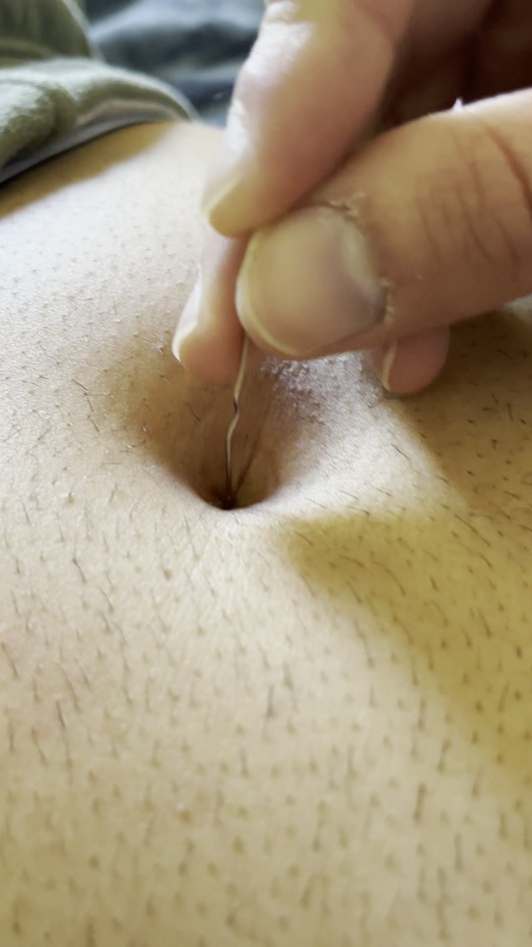 Paperclip in large navel 3