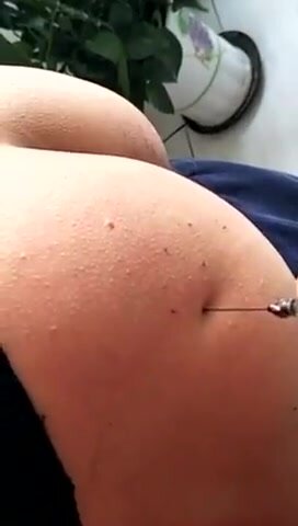 tight injection