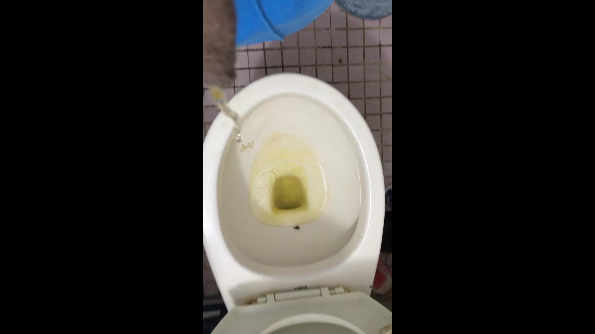 Amputee pee 台灣