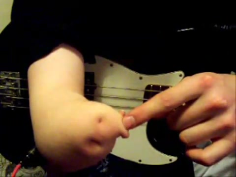 Congenital arm amputee guitar player