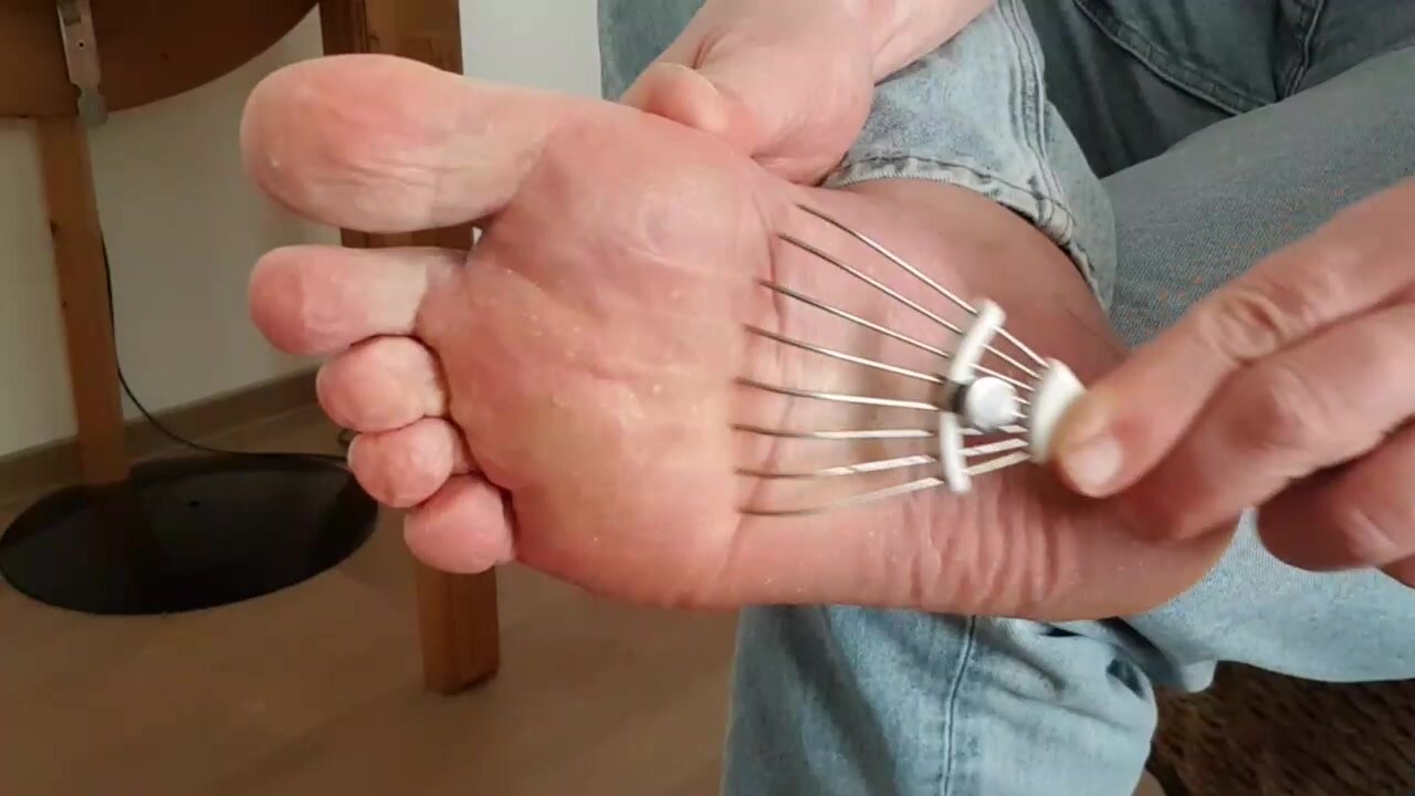 An itchy foot