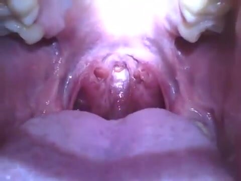 Inside A Giant's Wet Mouth