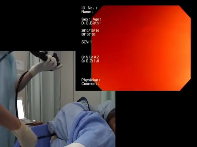 japanese colonoscopy video7.