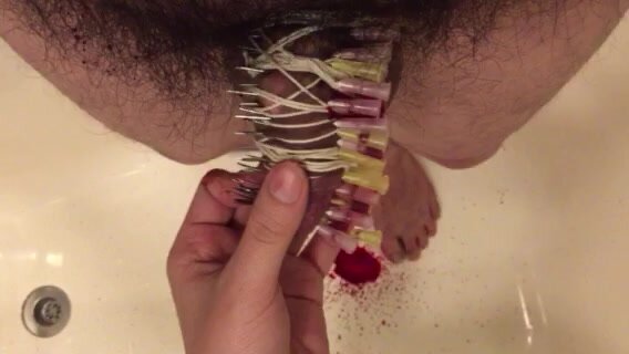 Mistress removing 40 needles from my dick!!