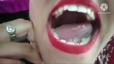 Teeth - video 7