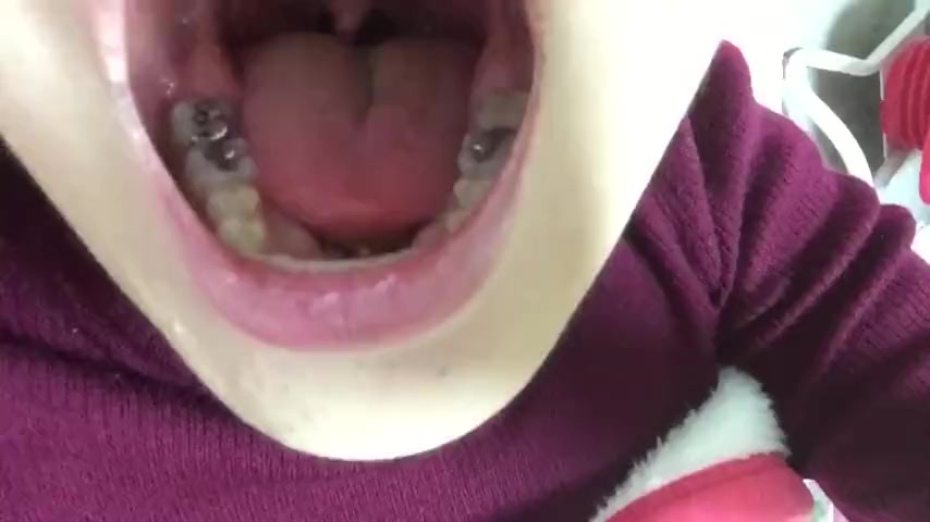 Japanese uvula and teeth