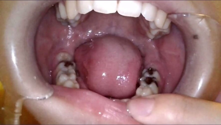 teeth - video 2