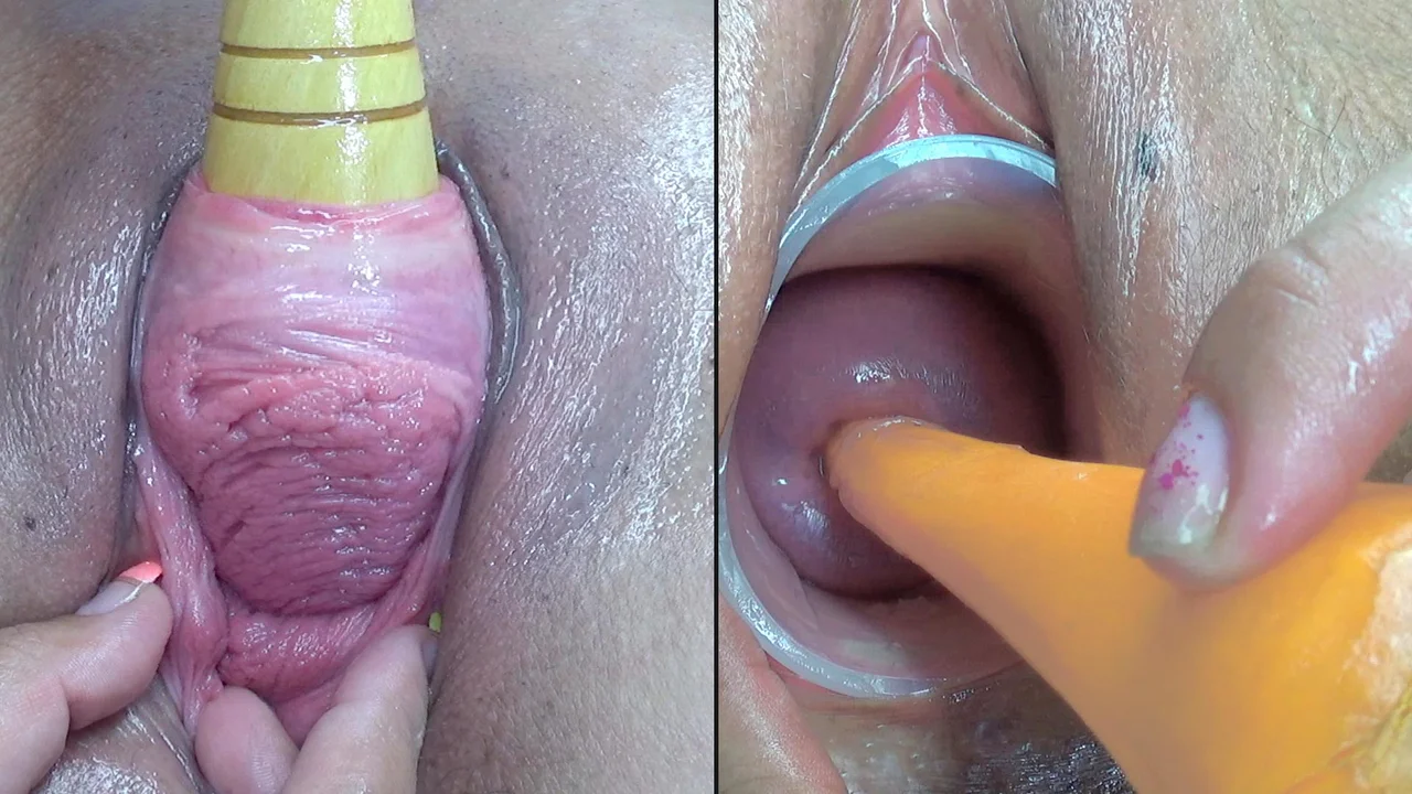 Lesbian Licking Cervix - Lesbians Pee Hole Penetration and Cervix Fucking - ThisVid.com