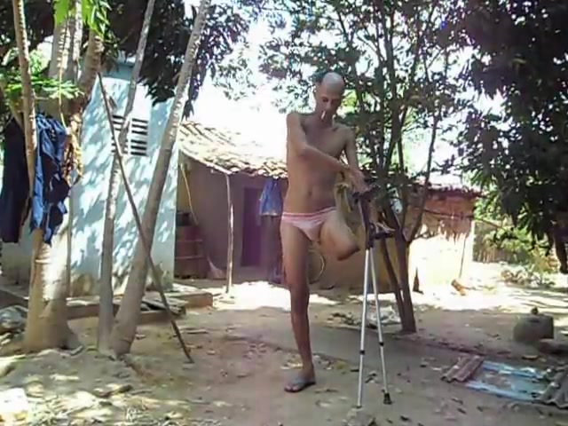 amputee crutching