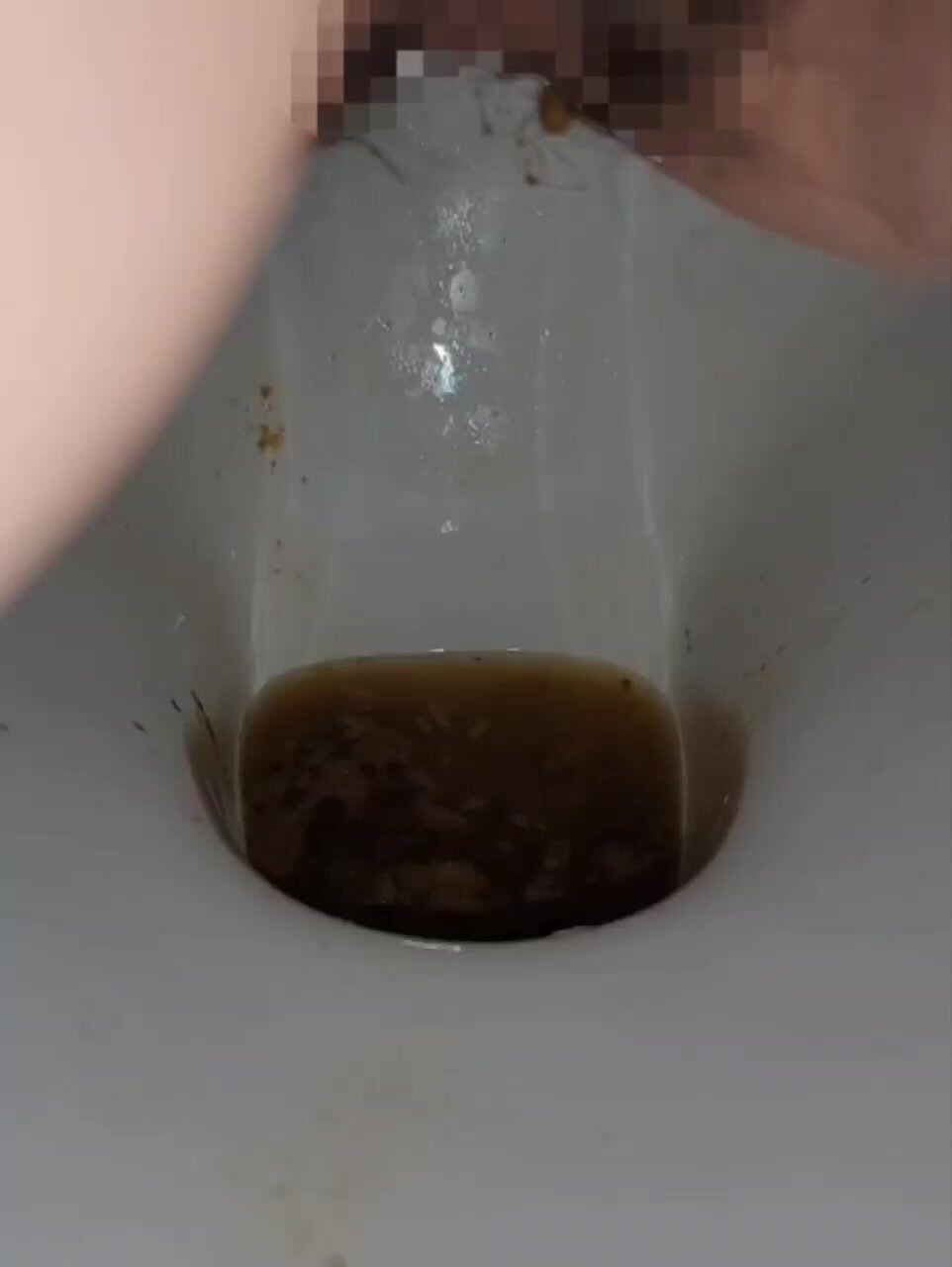 diarrhea7 - video 2