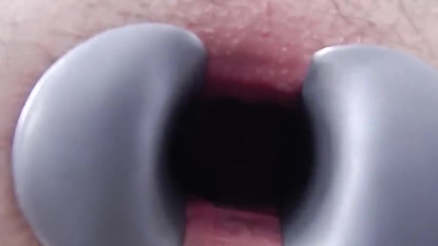 Mark Speculum