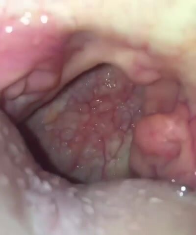 Mouth and Throat POV