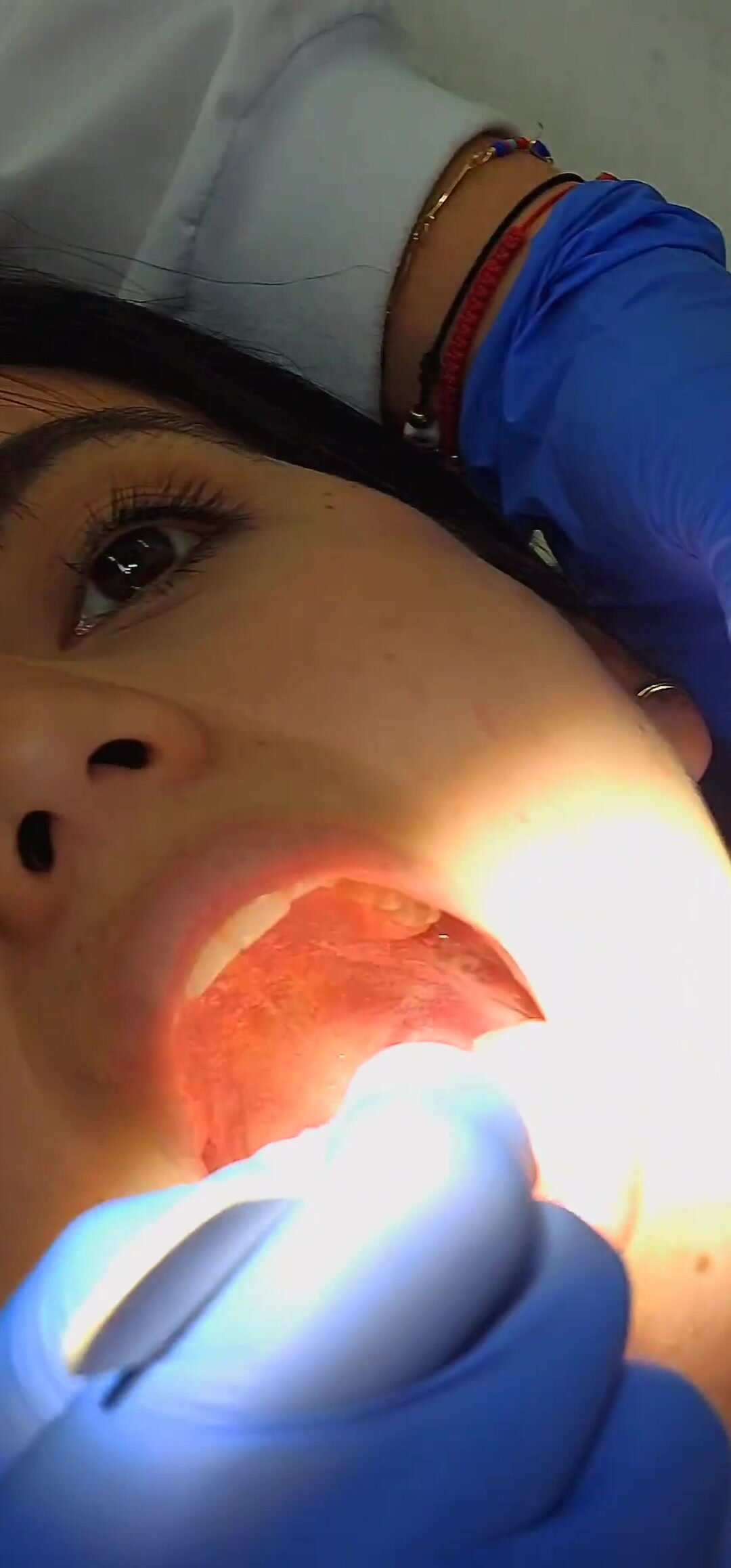 Woman's uvula in mouth inspection