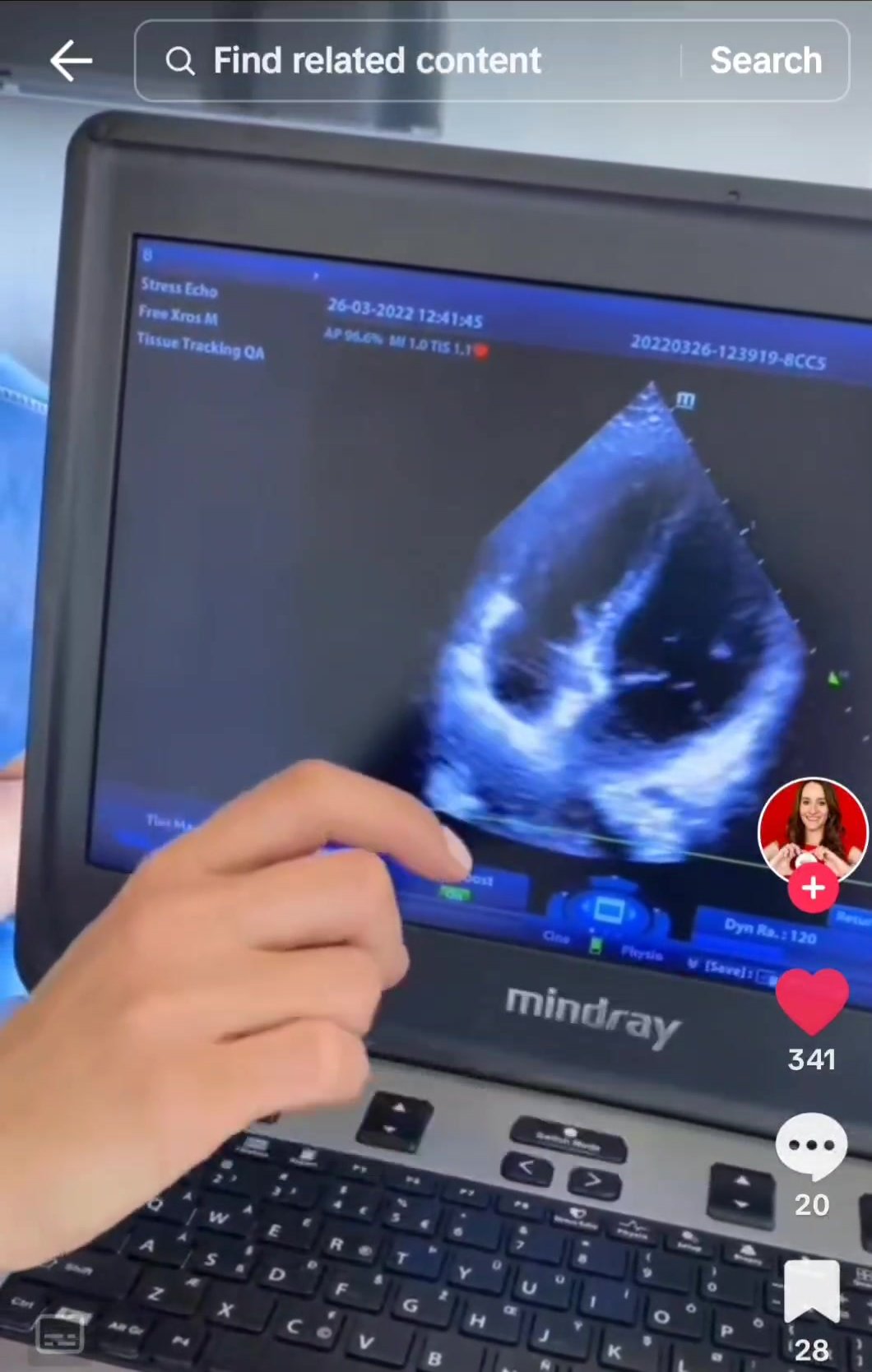 Woman doctor shows her echocardiogram