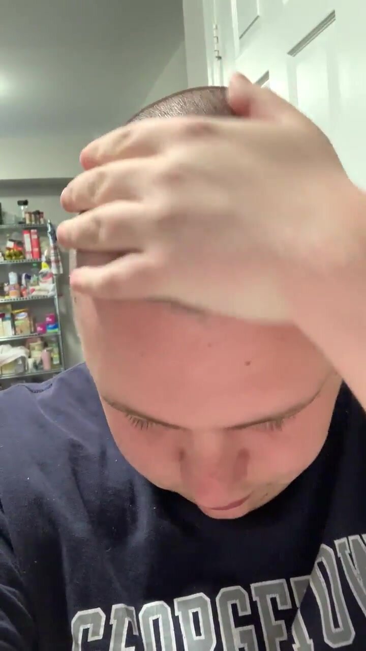 Faggot Rubs Bald Head