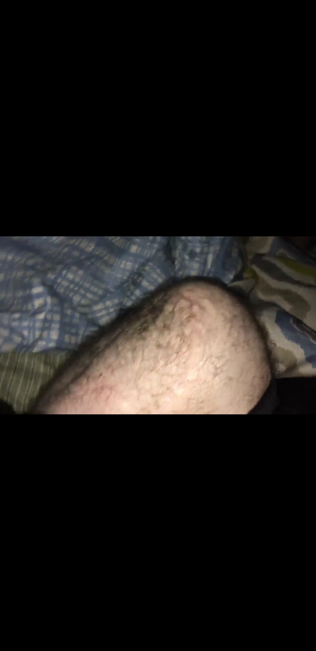Hairy short stump