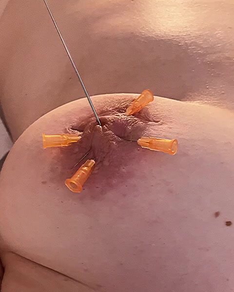 Breasts in needle pain