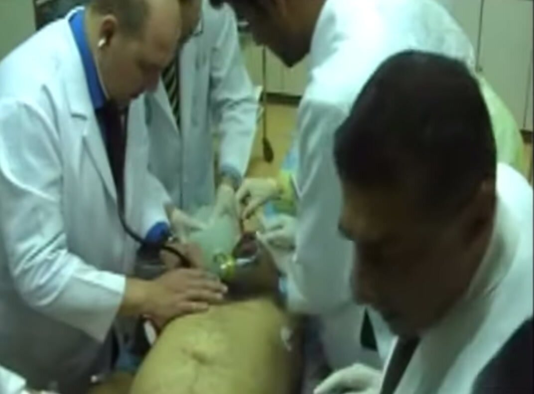 Real resuscitation attempt on man in cardiac arrest