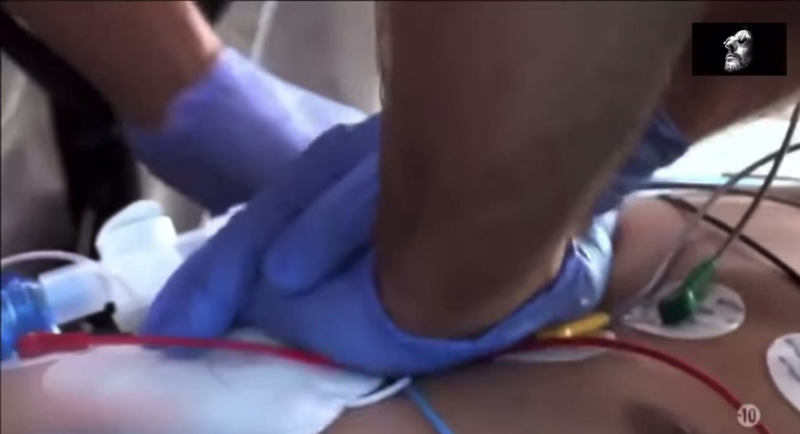 Resuscitation on man in cardiac arrest