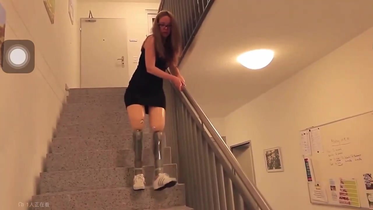 Dak woman practice walking on prosthetics